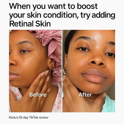 Mödénhaus™ Retinal SkinGlow Serum