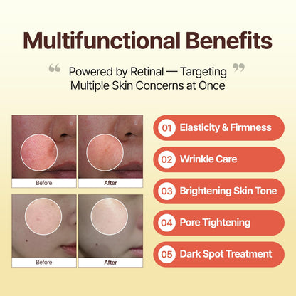 Retinal Skin Booster Serum – Beginner-Friendly, Non-Irritating Retinol for Face and Body – Pore Minimizer, Wrinkle Treatment, Glass Skin – Korean Skin Care, 5.07 Fl. Oz Large Size